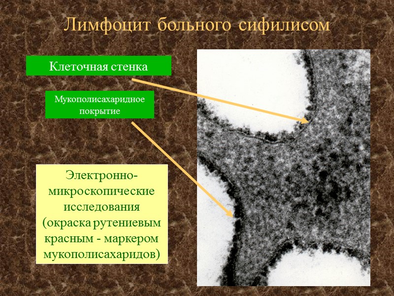Лимфоцит больного сифилисом Электронно-микроскопические исследования  (окраска рутениевым красным - маркером мукополисахаридов) Клеточная стенка